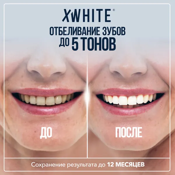 XWHITE Крем-гель для отбеливания зубов