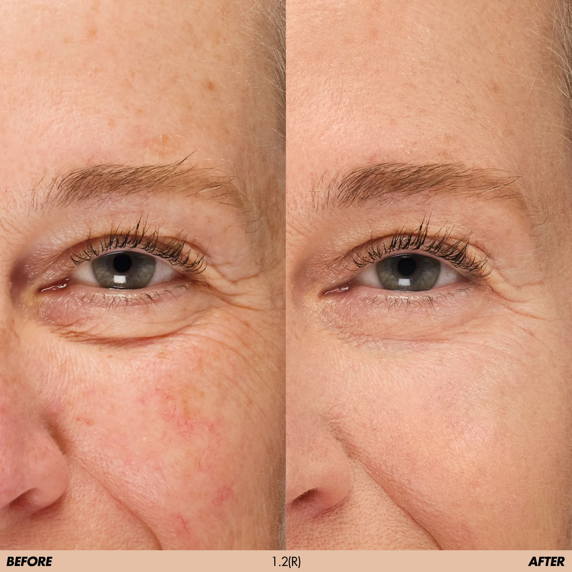 HD SKIN CONCEALER Консилер для области вокруг глаз