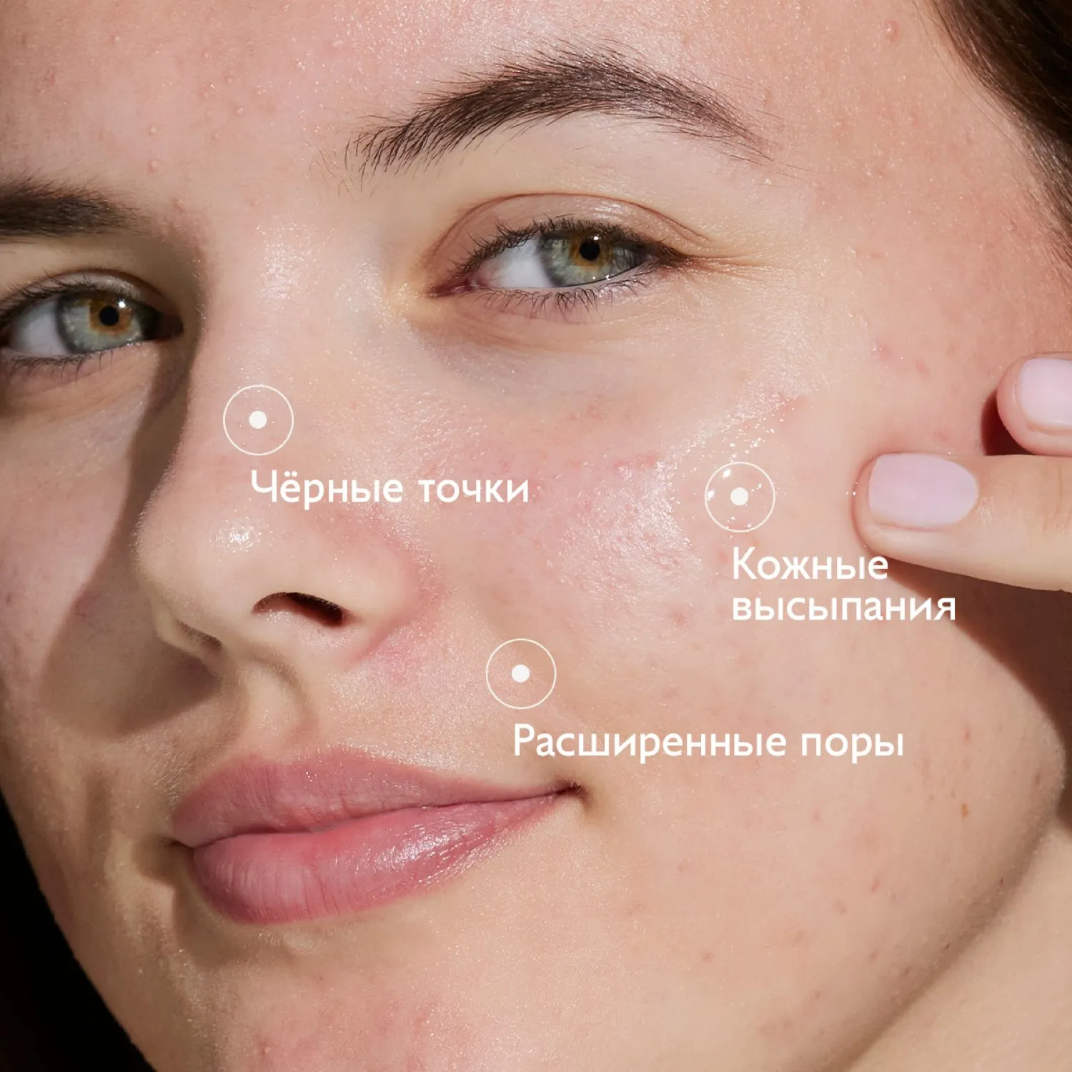 VINOPURE Сыворотка для проблемной кожи с салициловой кислотой