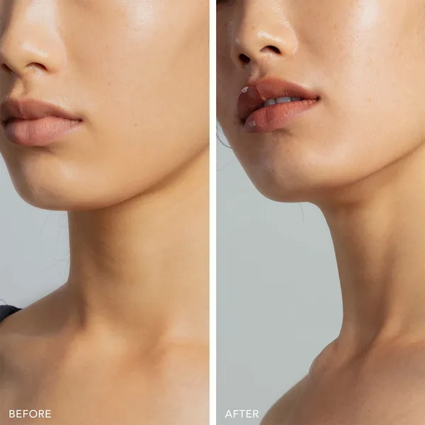 BEAR 2 GO Умные тонизирующие микротоки для лица