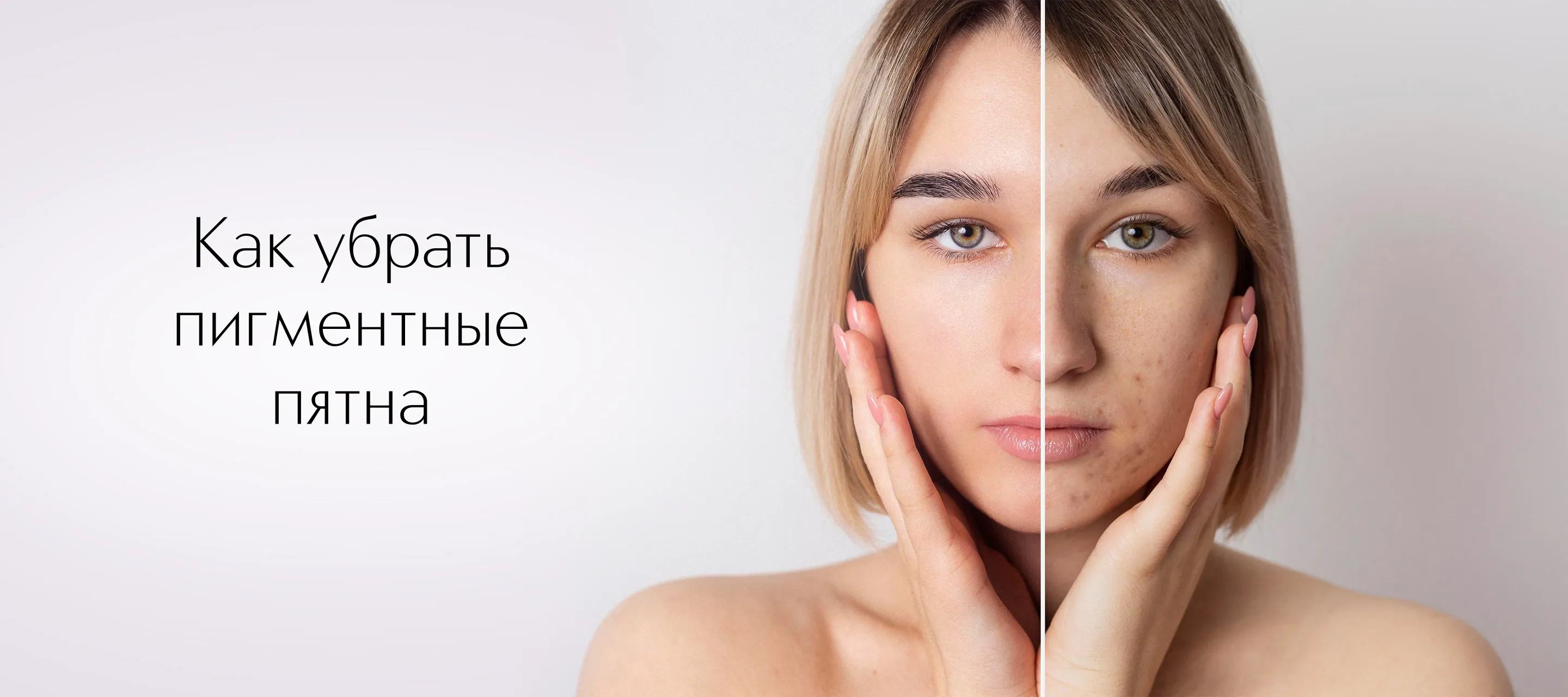 Как убрать пигментные пятна на лице: причины, уход и средства, которые работают